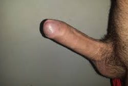 (1)